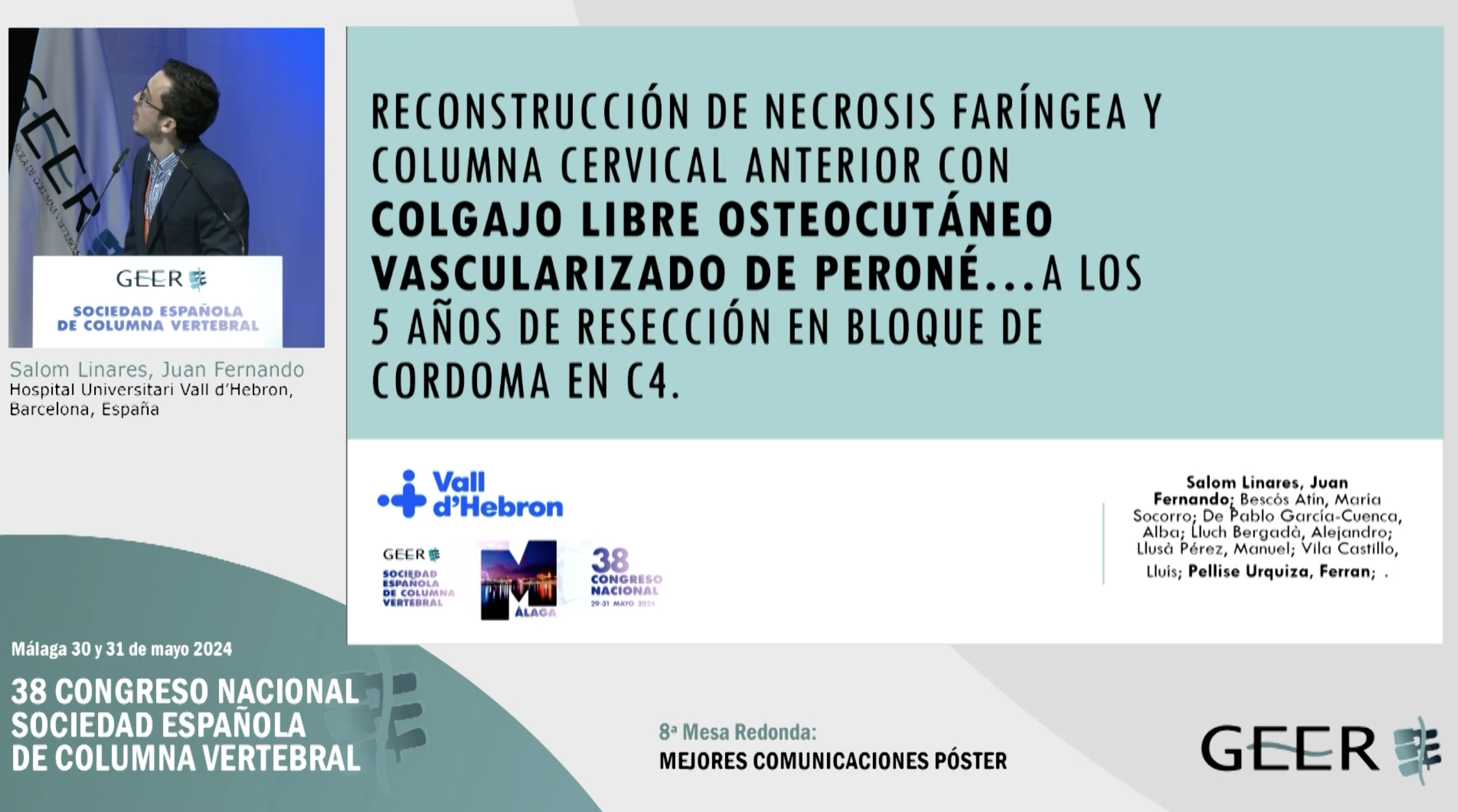 C.P.2. Reconstrucción de necrosis faríngea y columna cervical con colgajo libre osteocutáneo vascularizado de peroné, a los 5 años de resección en bloque de cordoma en C4