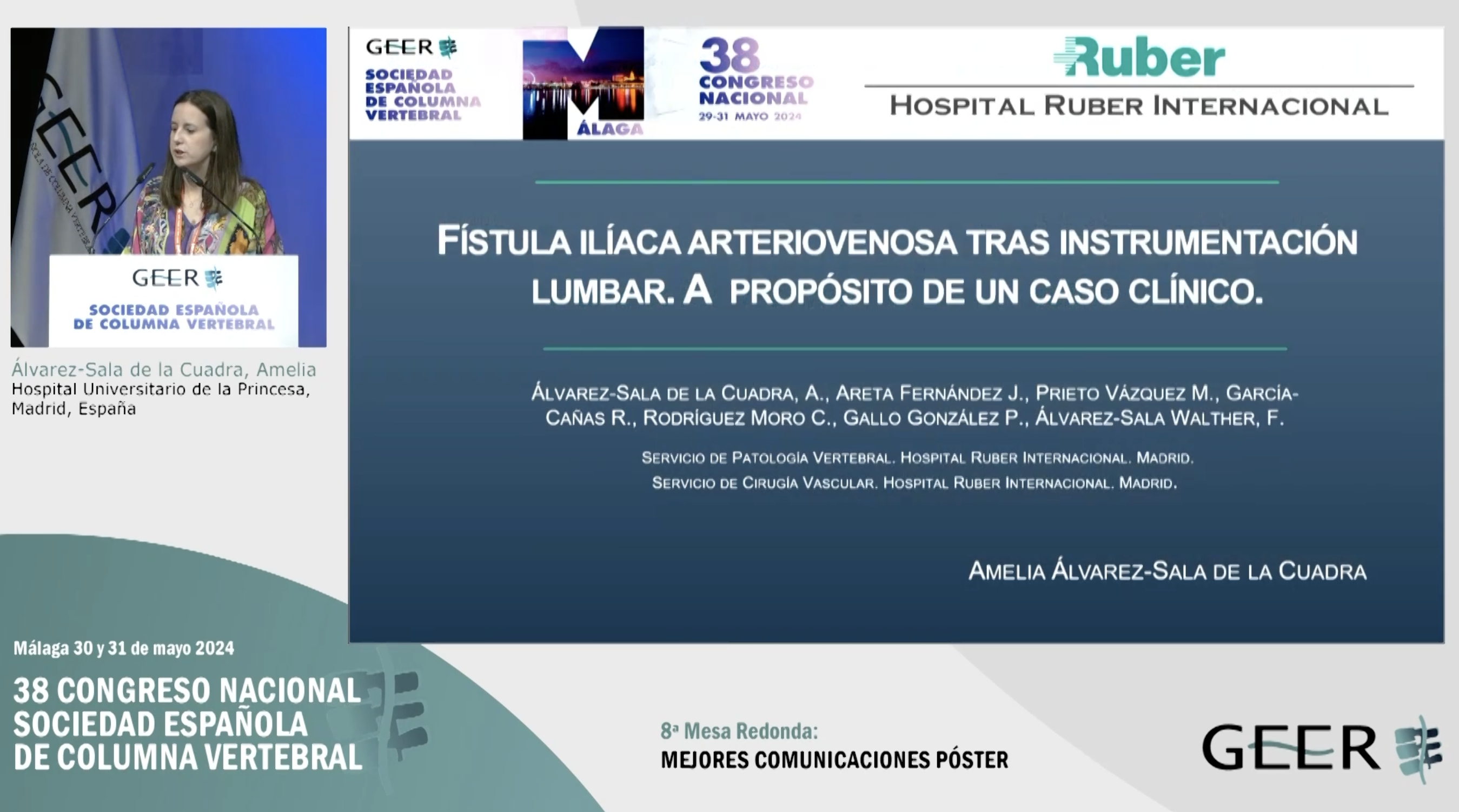 C.P.4. Fístula iliaca arteriovenosa tras instrumentación lumbar. A propósito de un caso clínico